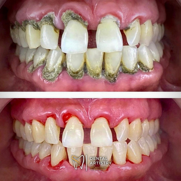 Slider image (2) Dental Artistry Dental Center